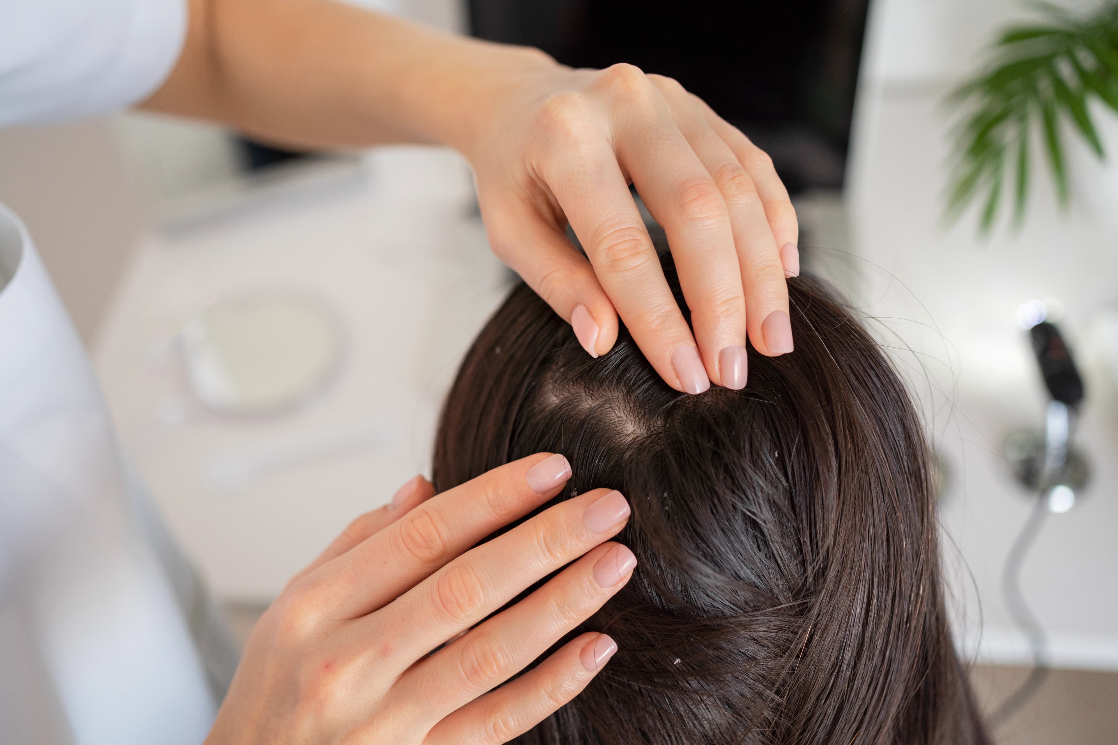 Female Hair Transplant treatment