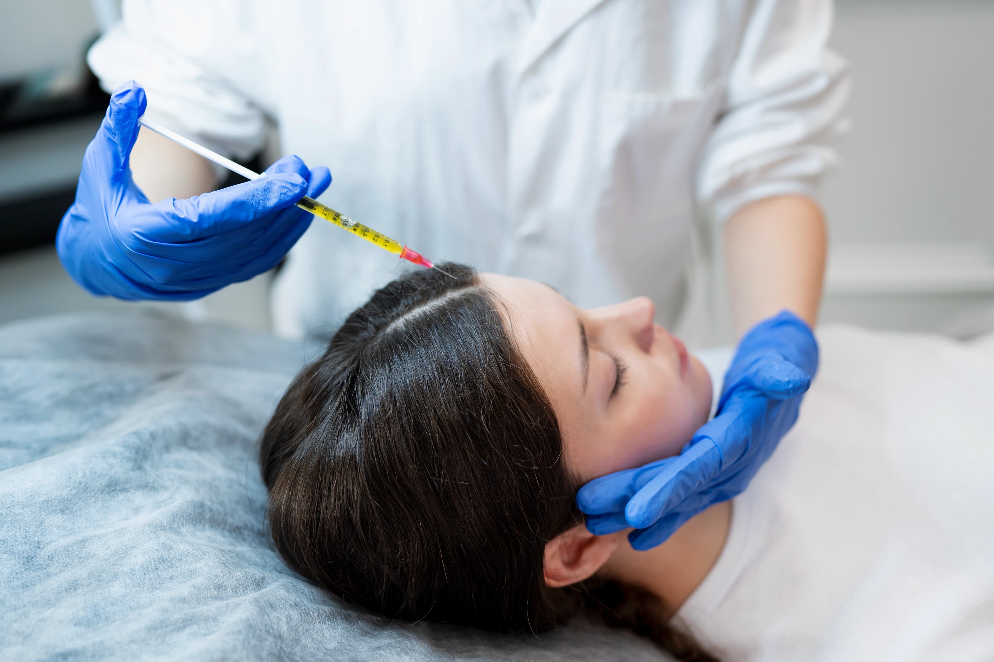 Platelet Rich Plasma for hair treatment