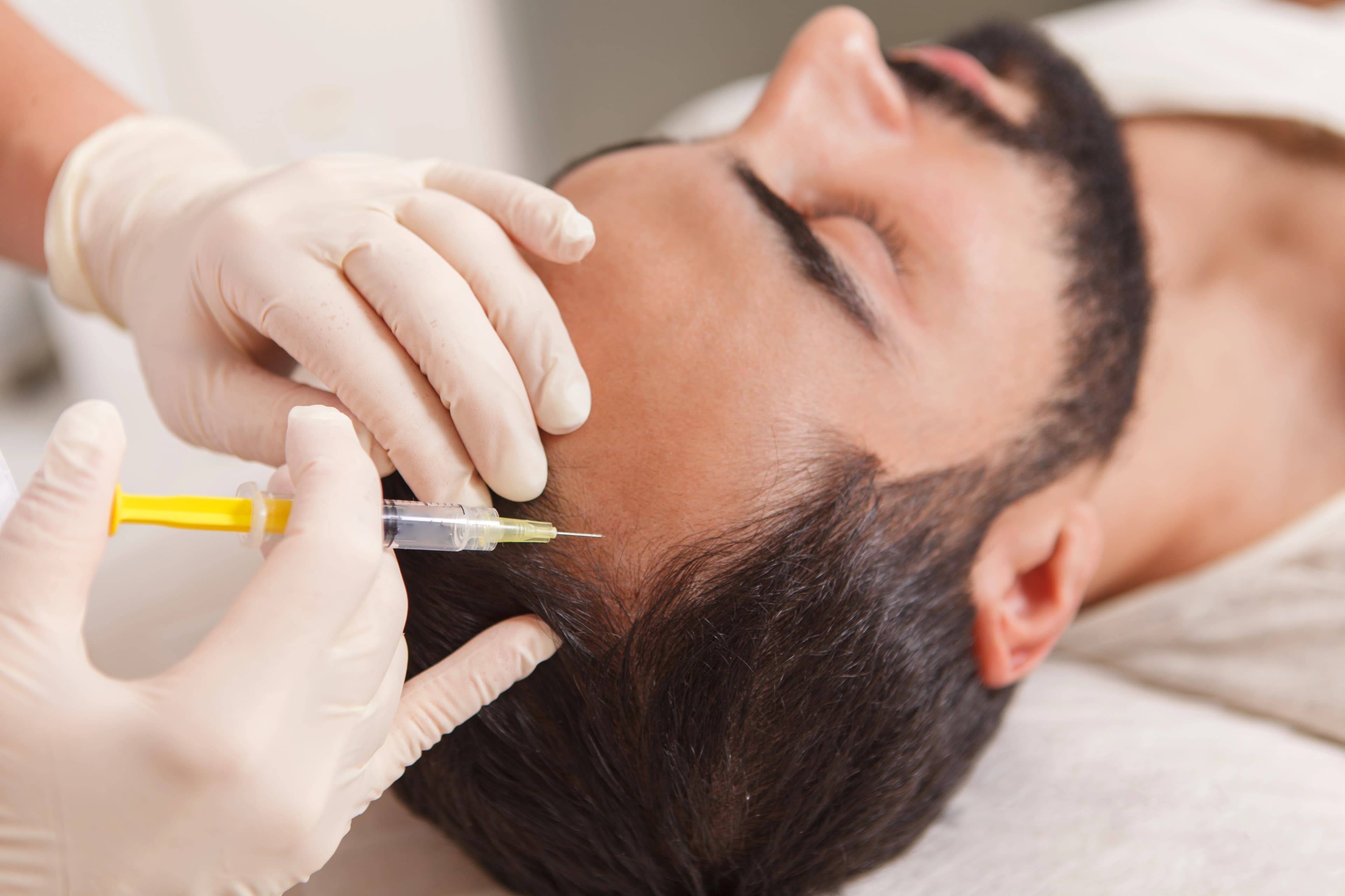 Platelet Rich Plasma For Hair Loss treatment