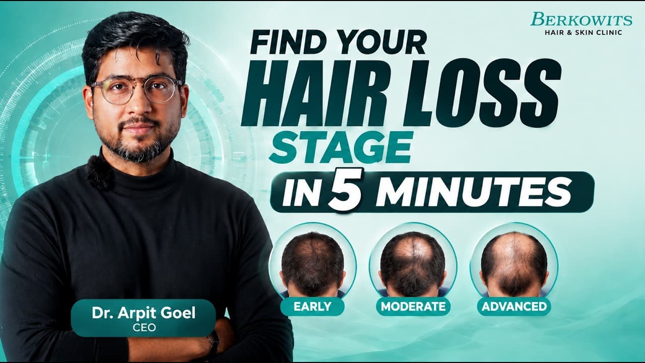 Take This 5 Minute AI Hair Assessment Before Any Hair Loss Treatment | Berkowits