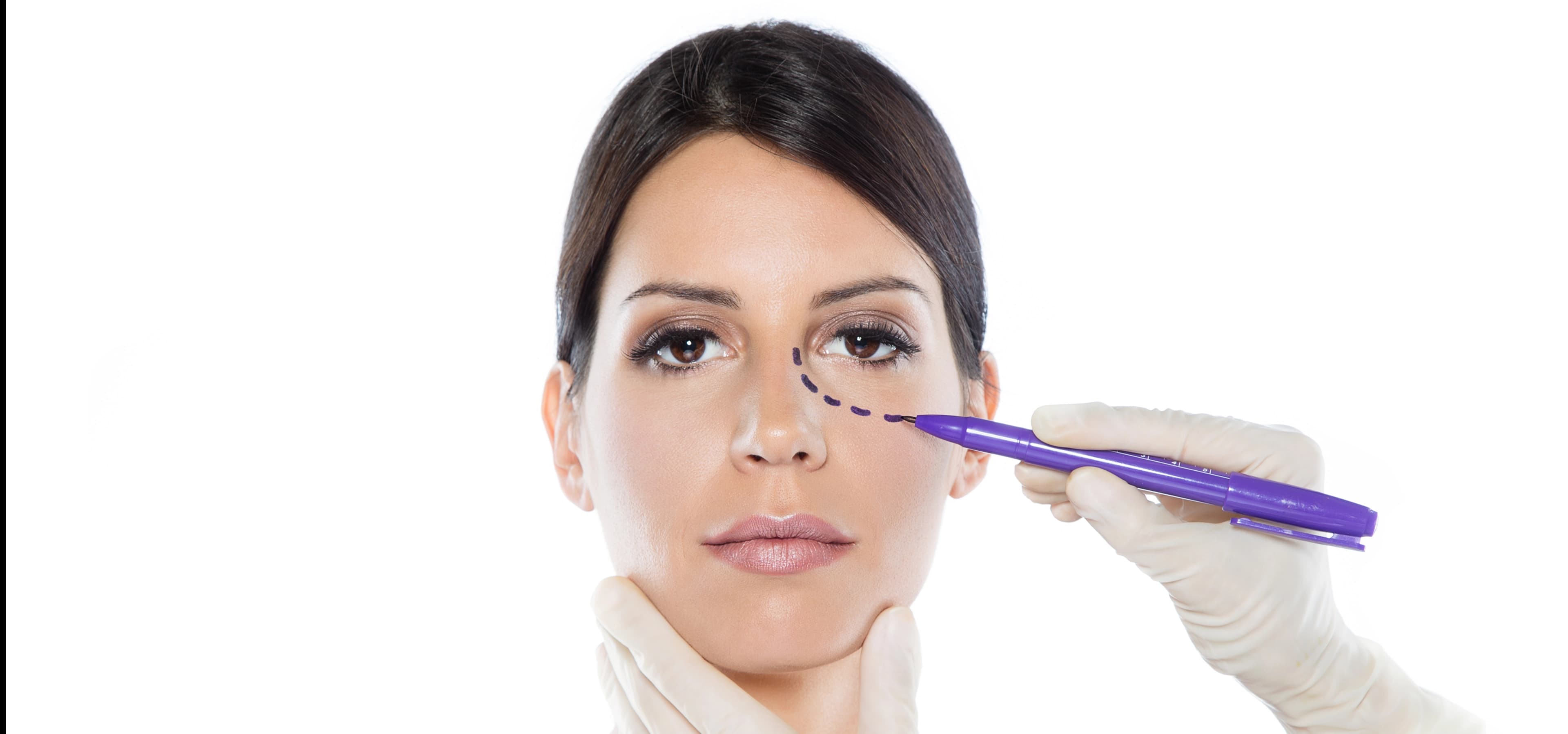 Threadlift Treatment
