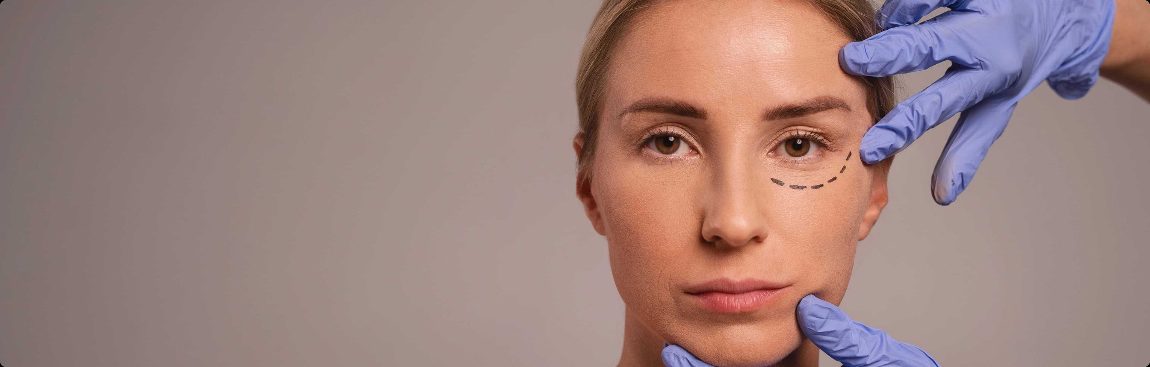 Threadlift Treatment