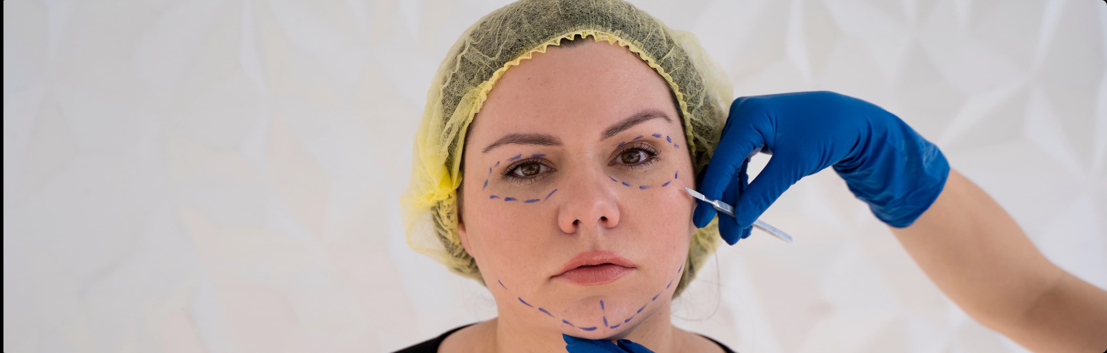 Threadlift Treatments