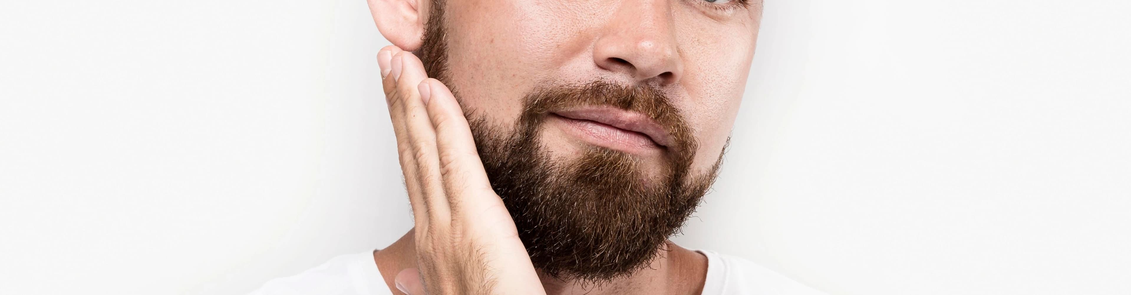 Patchy Beard Overview