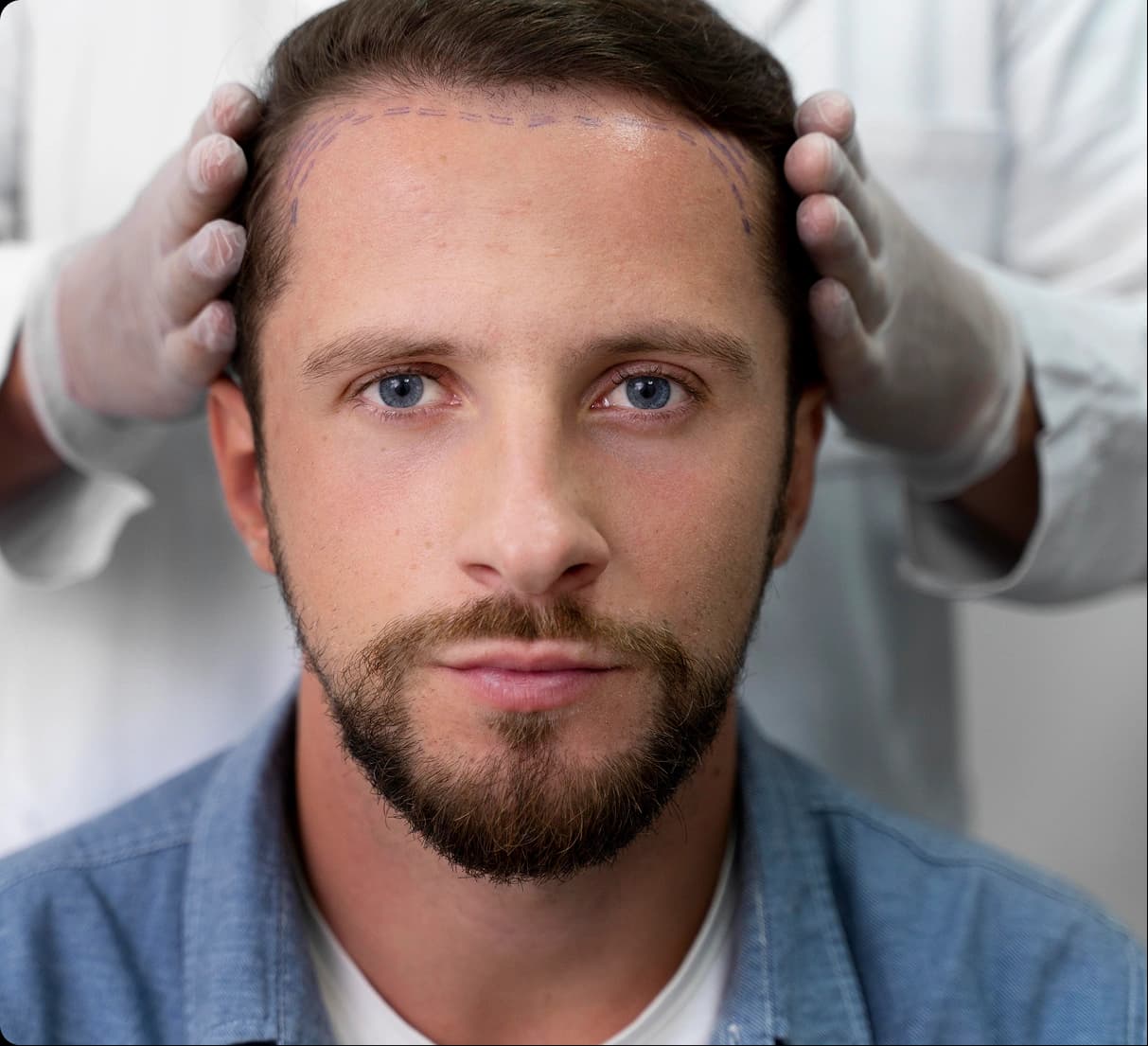 Canacode Injection Therapy