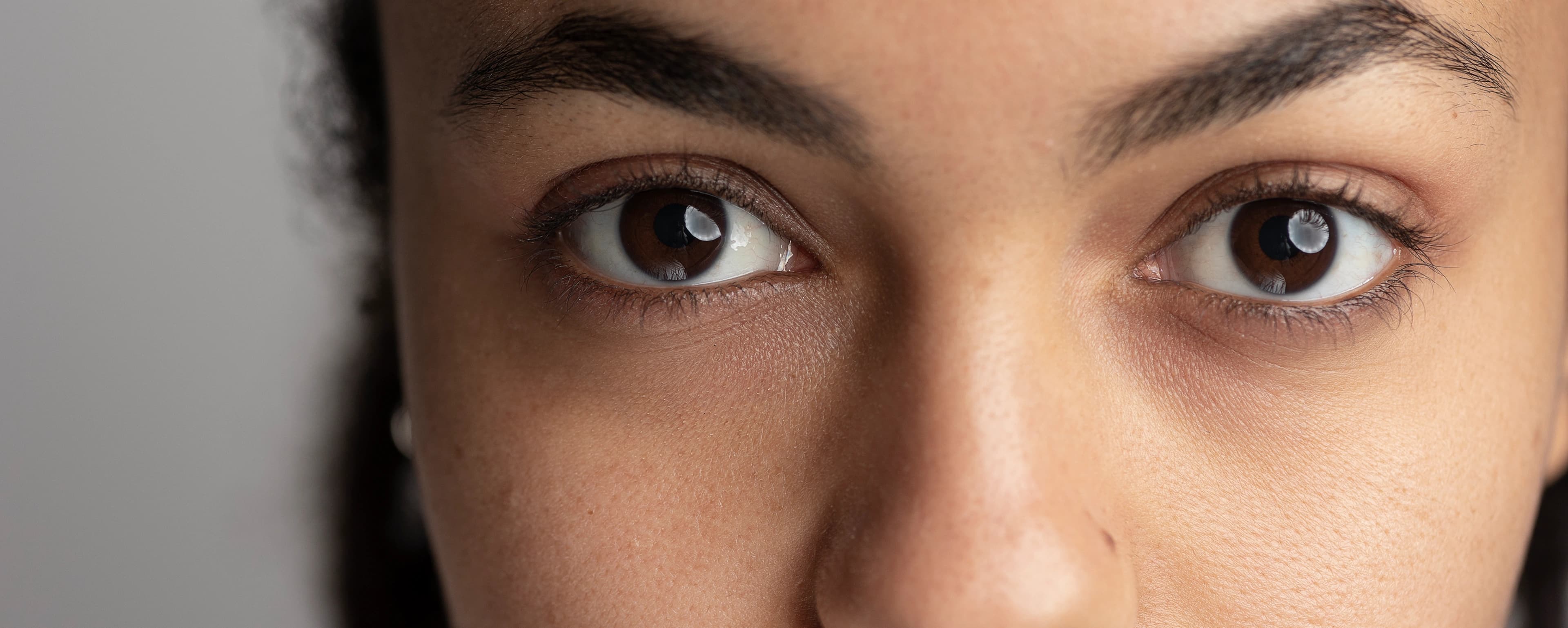 Dark Circles Treatment