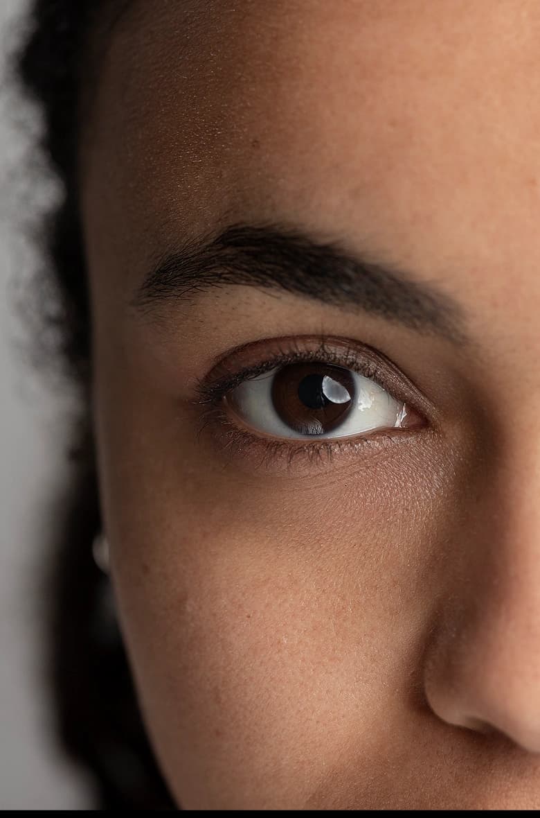 Dark Circles Treatment