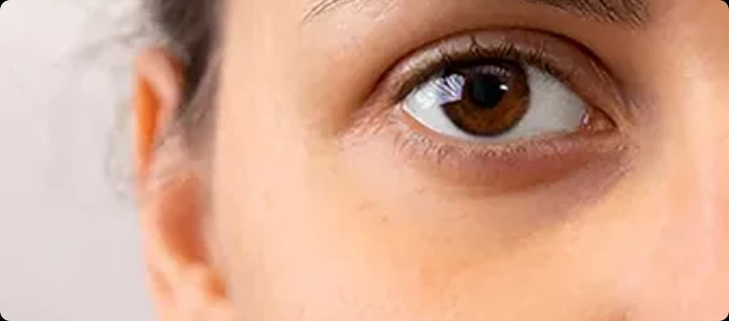 Hollow or Sunken Circles