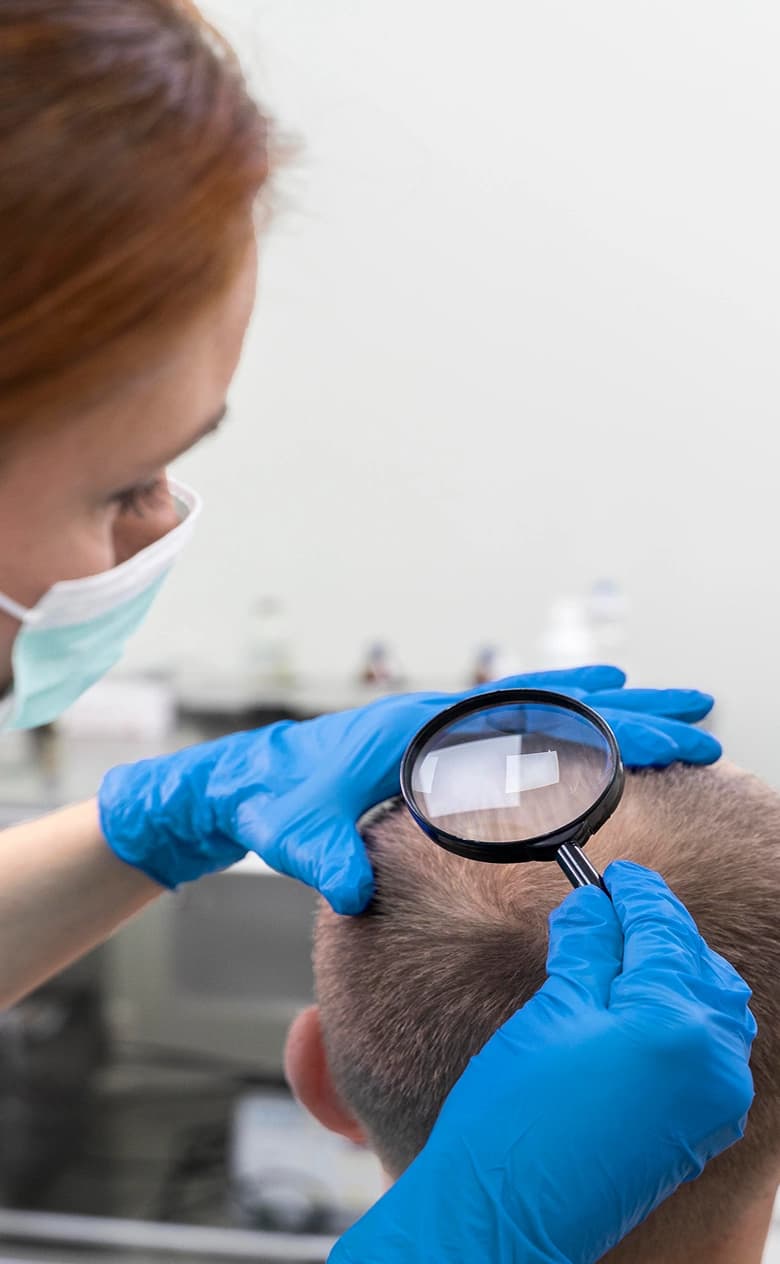 Autologous-Micrograft Treatment