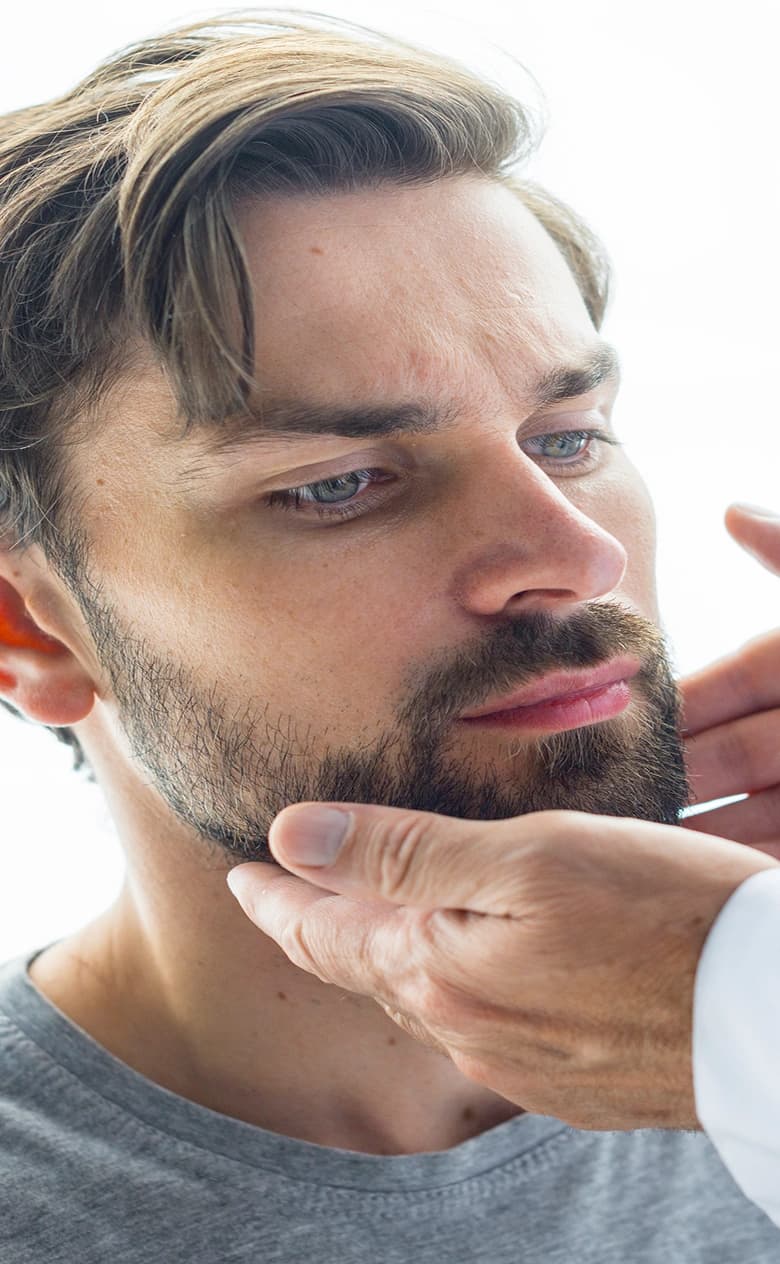 Beard Transplant