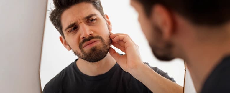 Beard Transplant