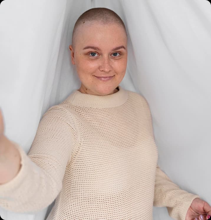 Hair wigs for chemotherapy