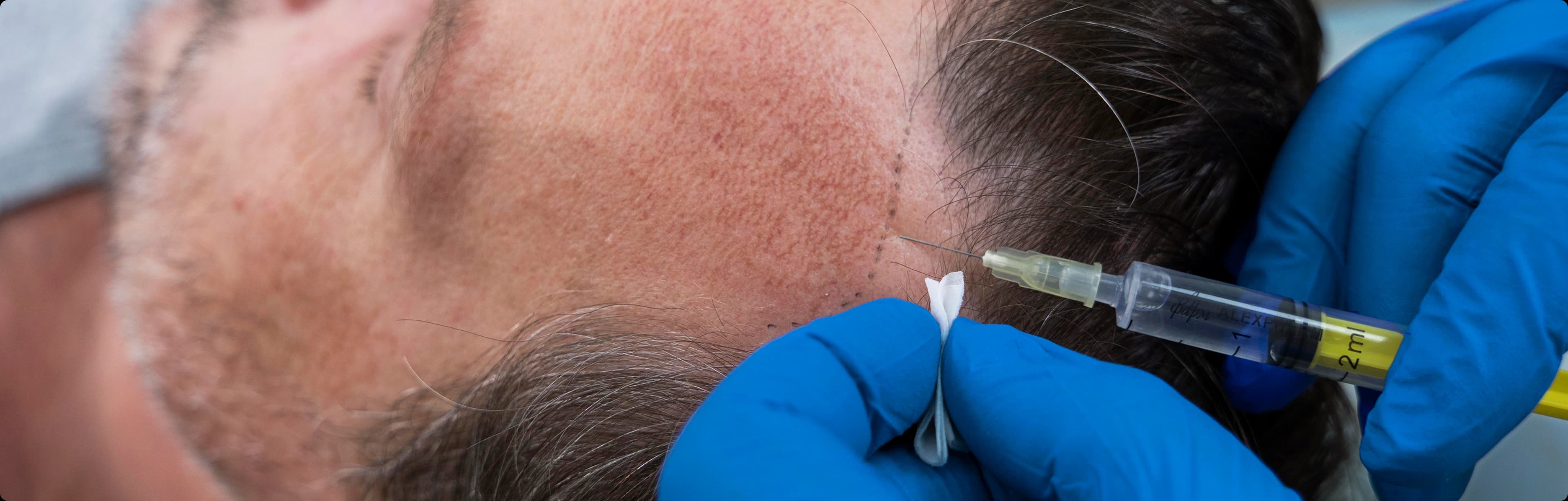 Combination treatments