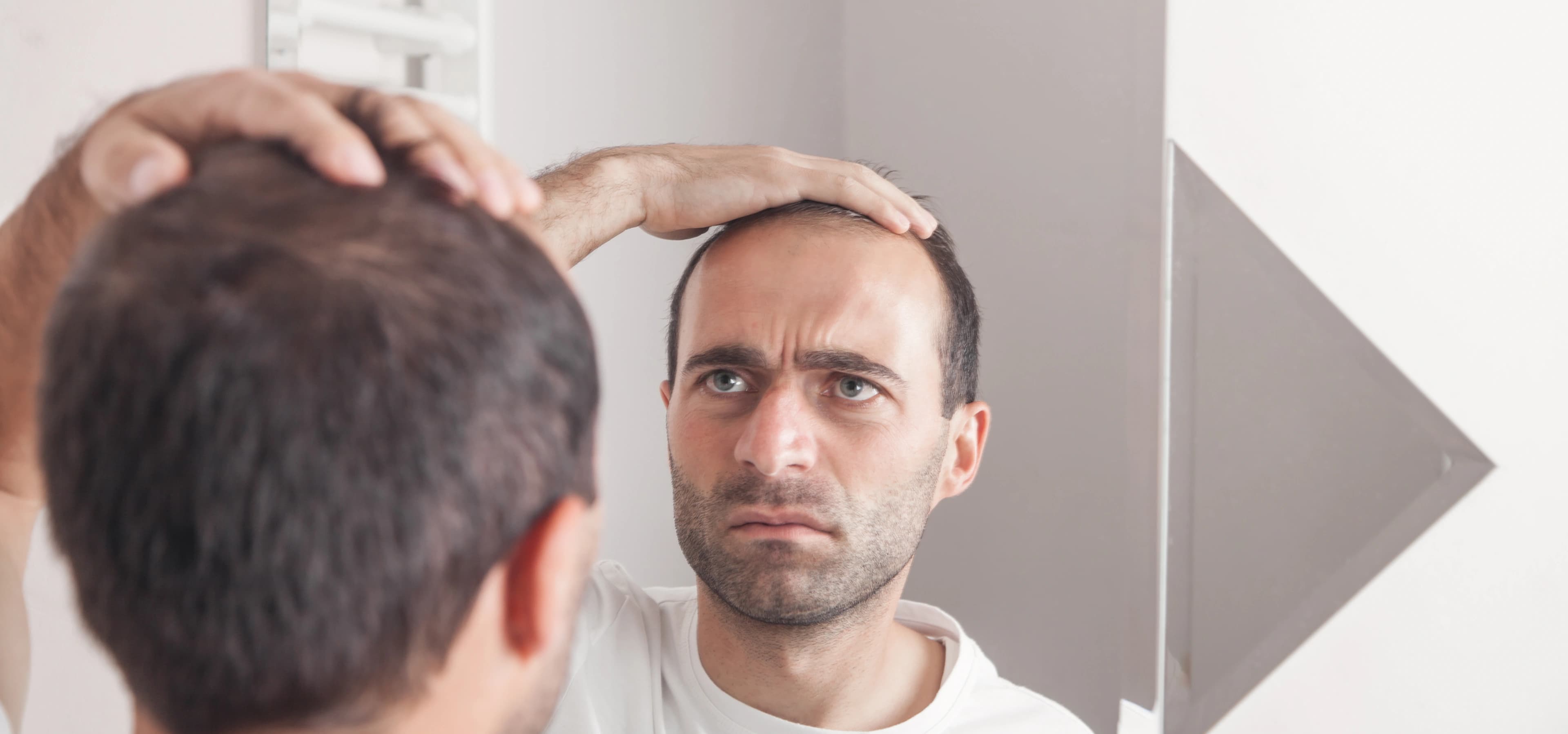 Non-Surgical Hair Replacement System