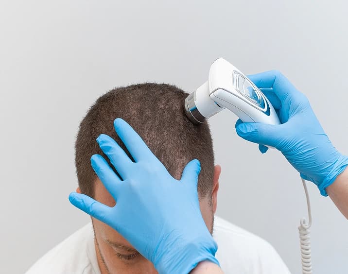 Hair System Consultation