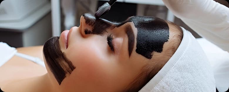 Carbon Facial Treatment