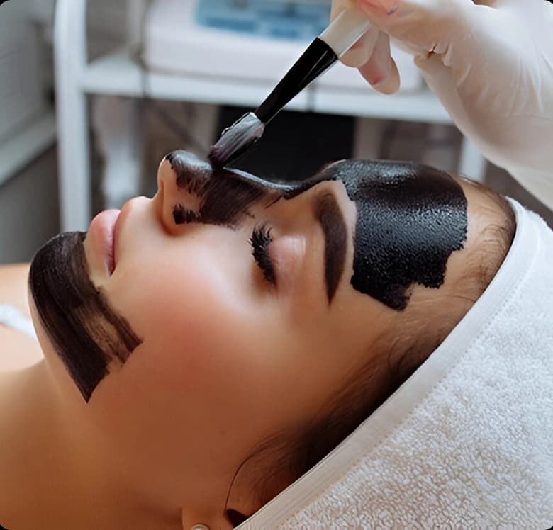 Carbon Facial treatment benefits
