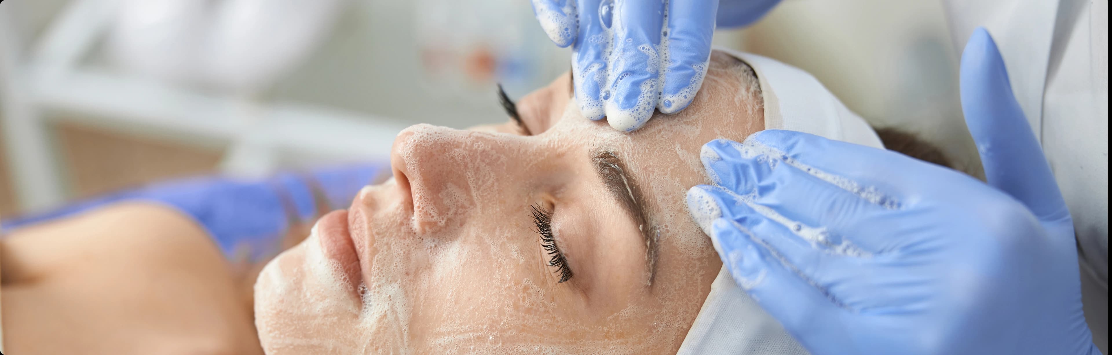 Chemical peel treatment benefits