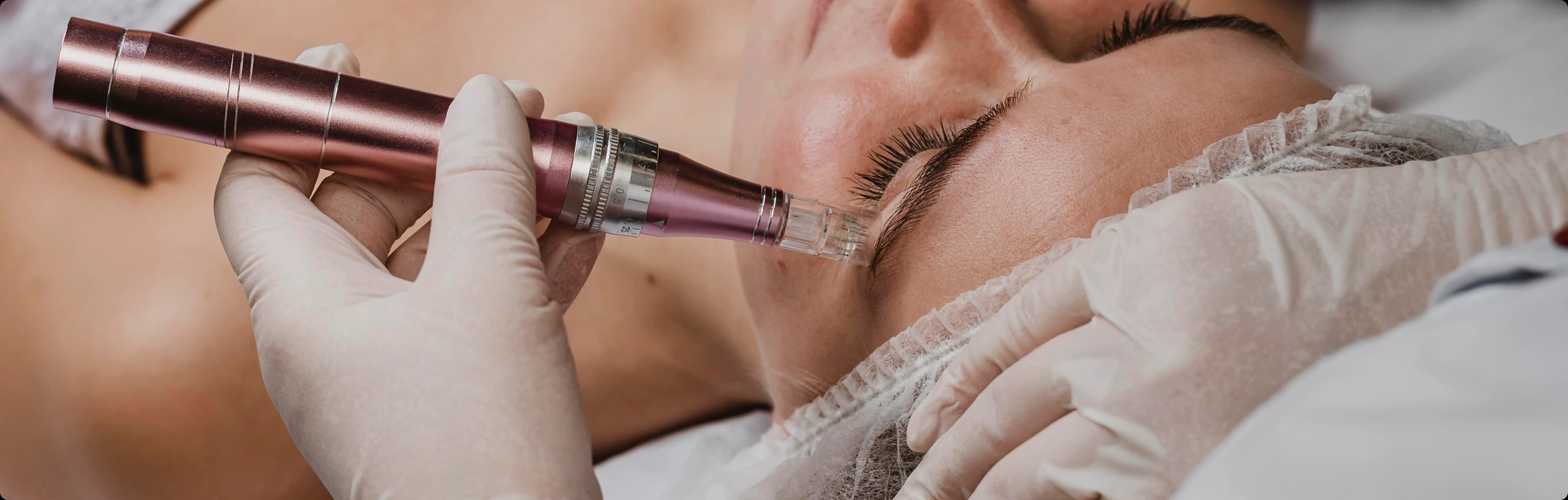 Collagen Induction Therapy