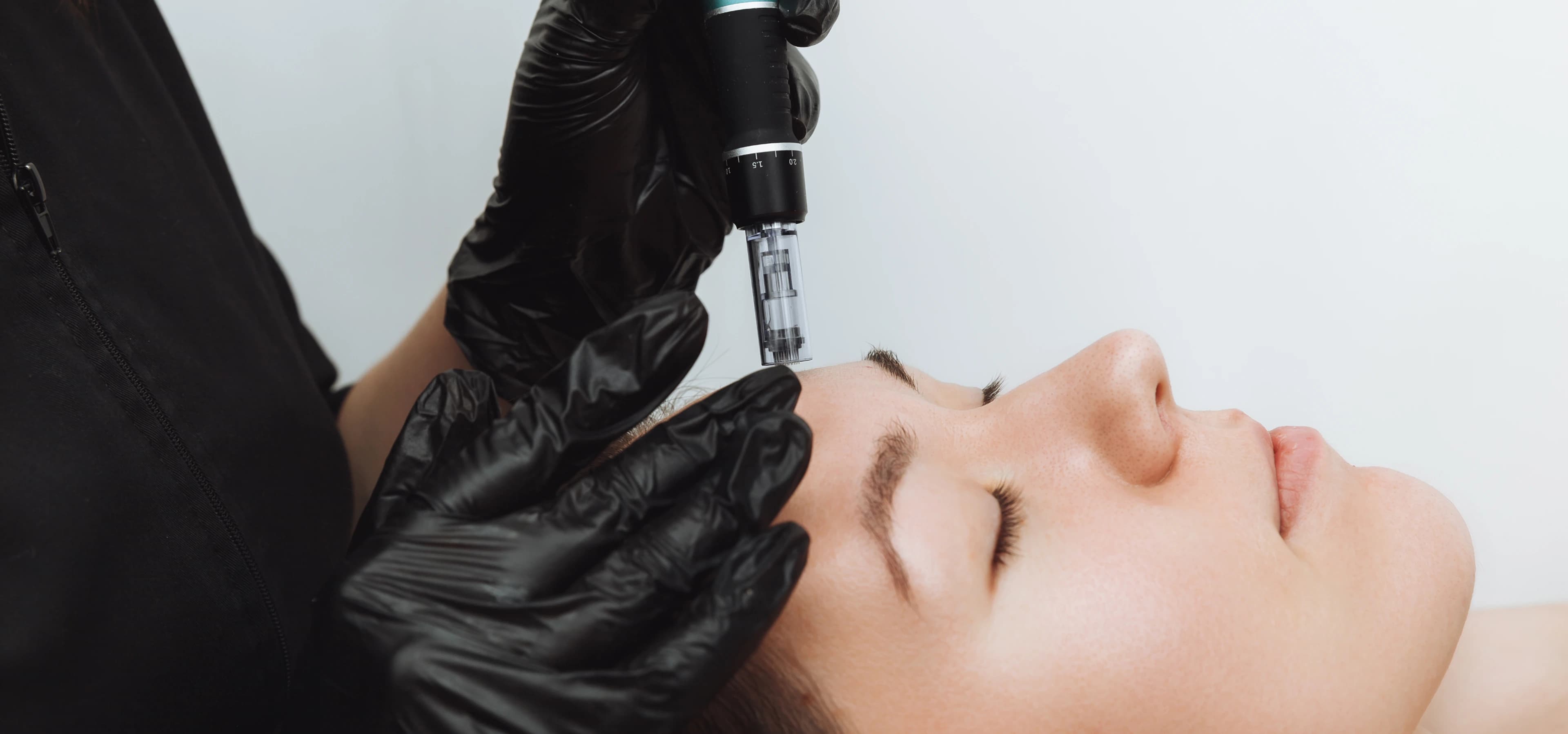 Mesotherapy Treatment
