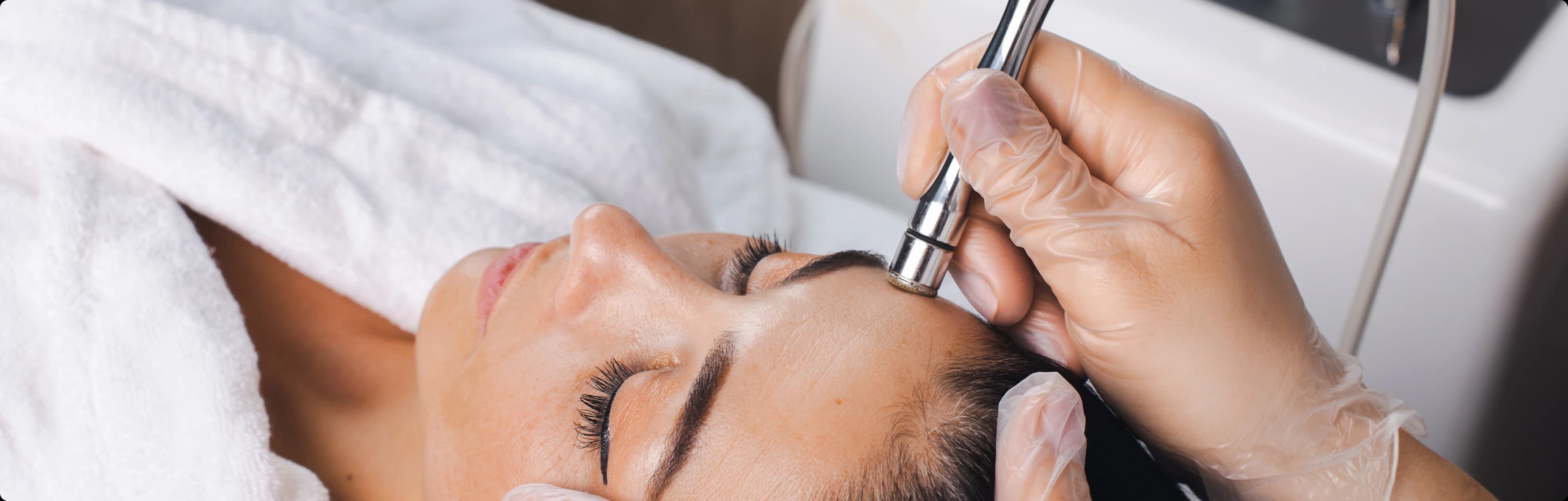 microdermabrasion treatment