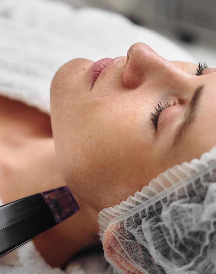 Microneedling facial