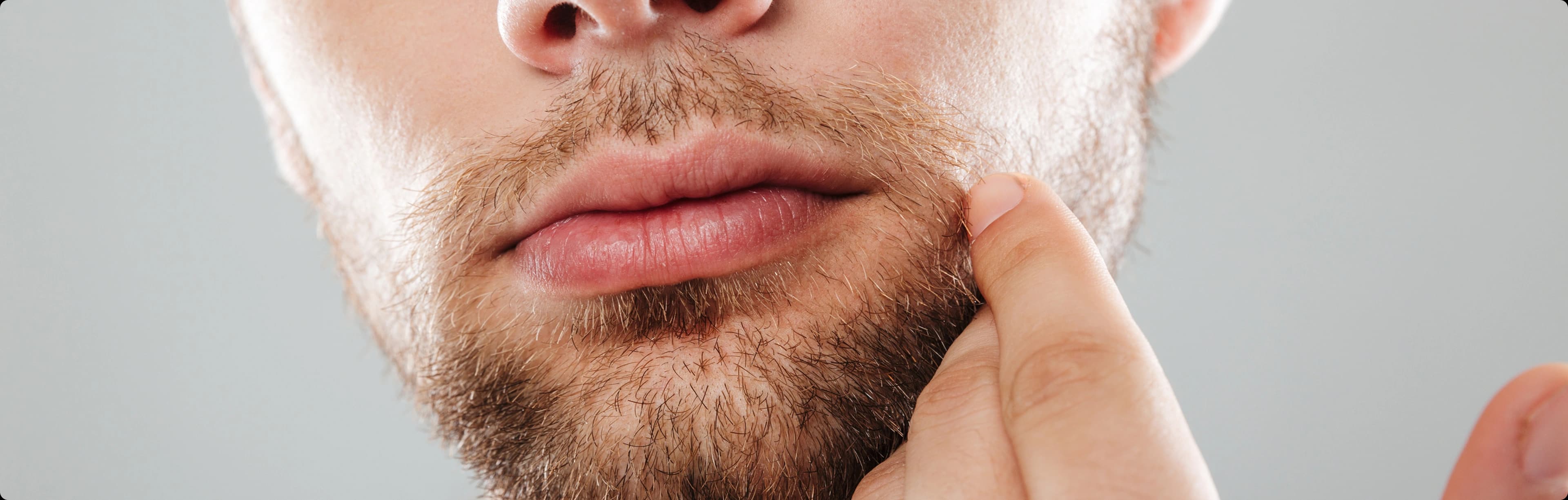 Beard transplant results