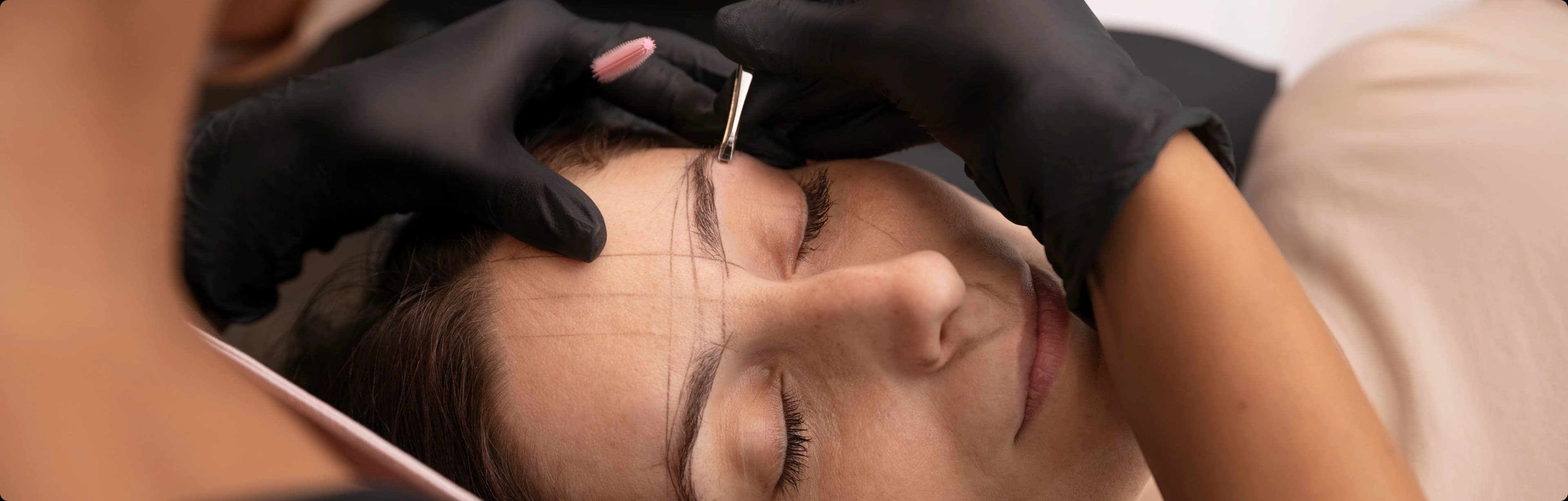 Customized facial hair transplant