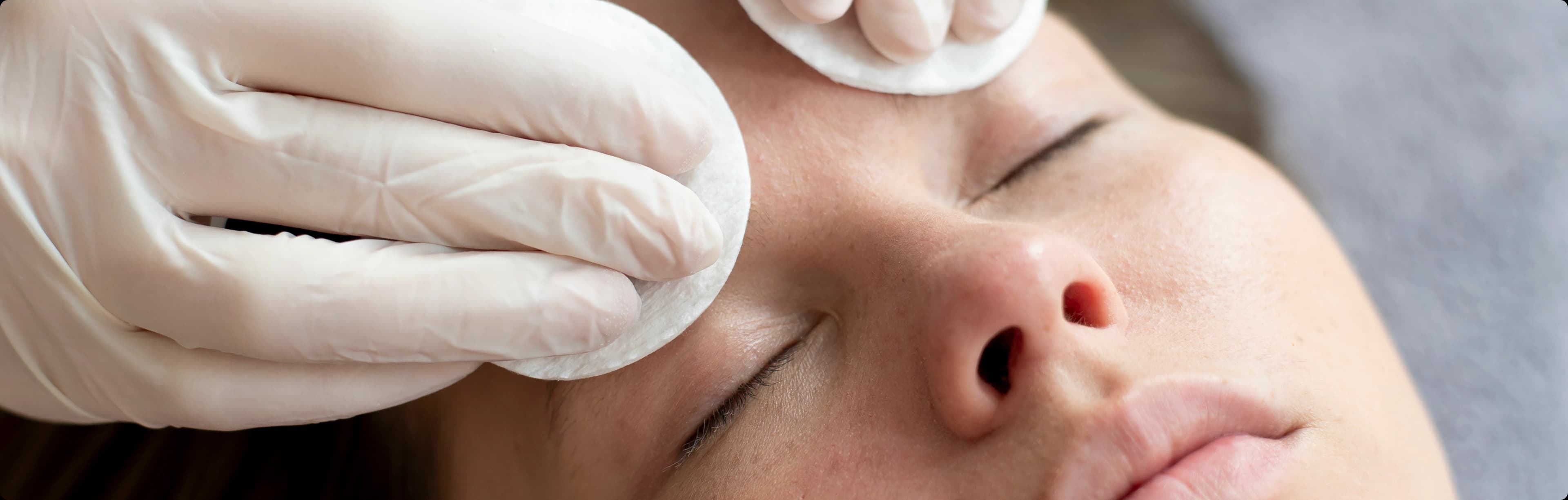 Eyebrow transplant procedure