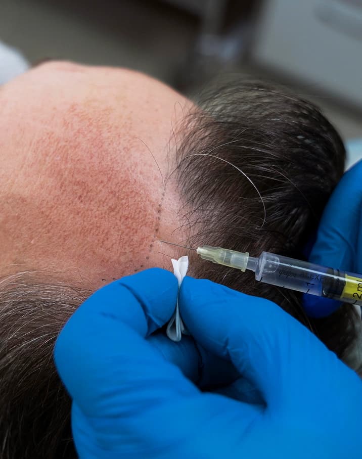 Combination treatments