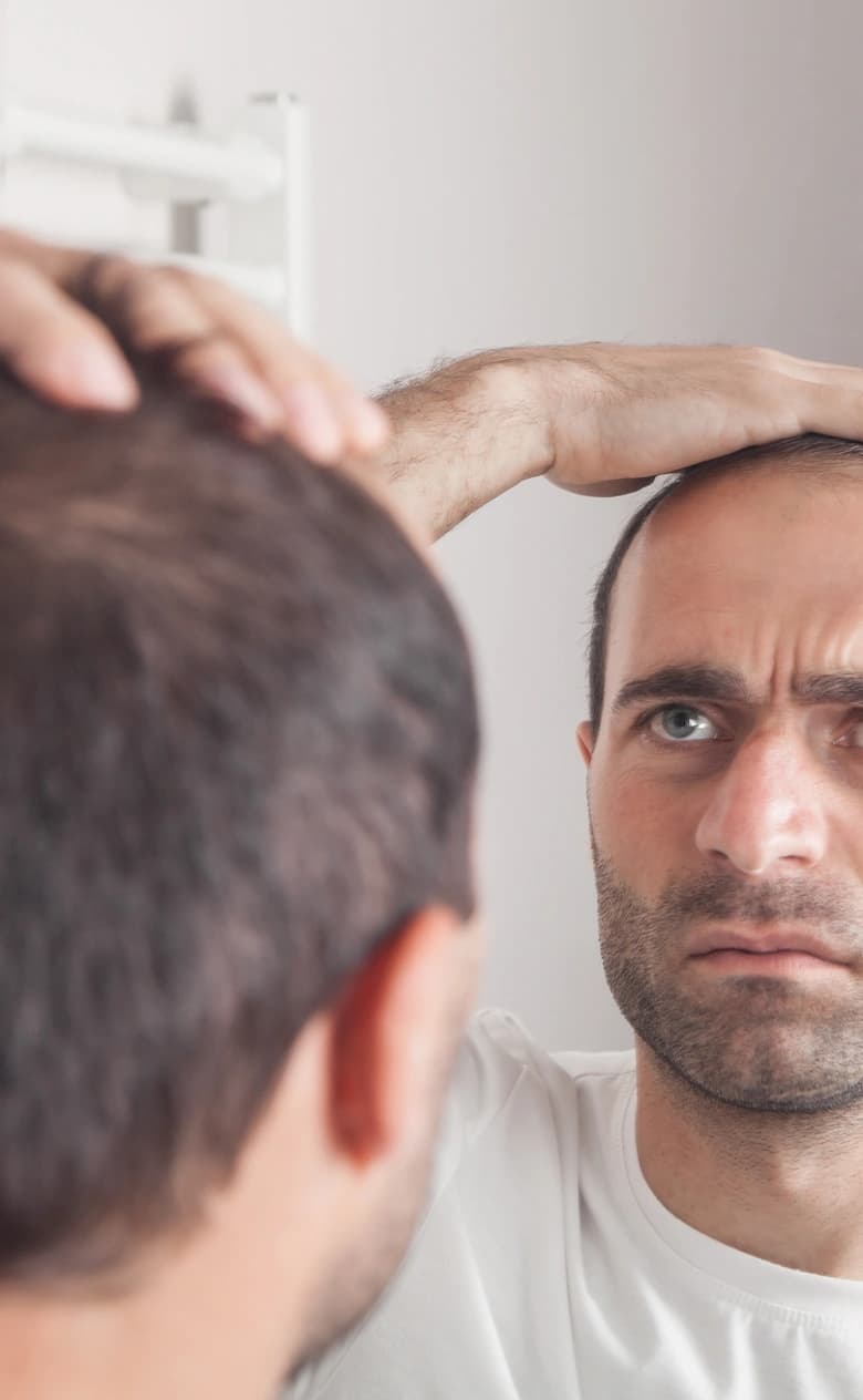 Non-Surgical Hair Replacement System