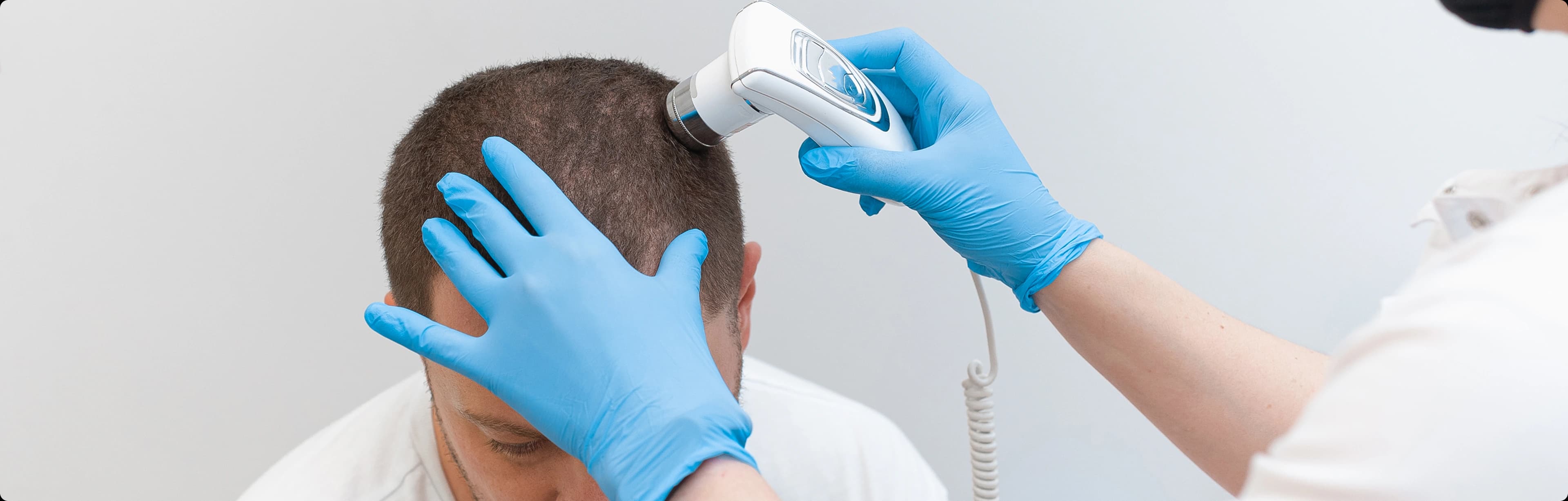 Hair System Consultation