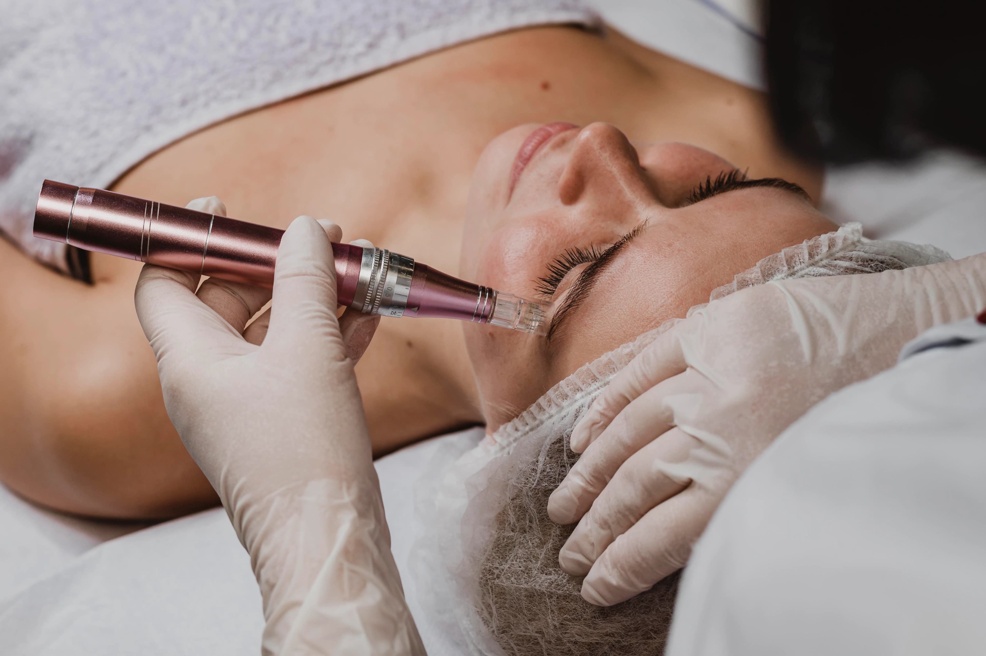 Microdermabrasion treatment