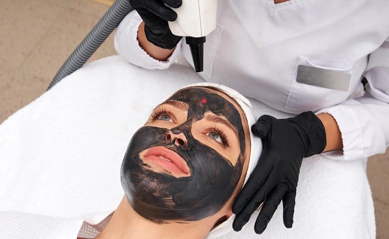 Carbon Facial results