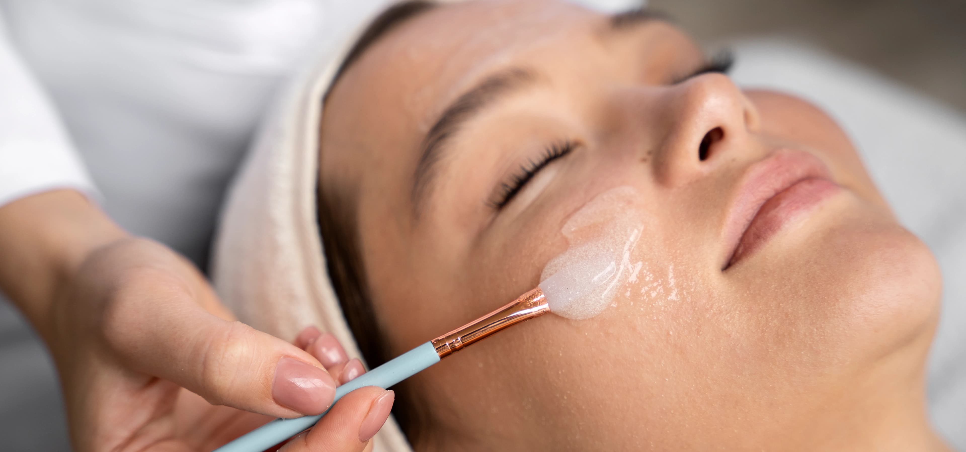Chemical Peel Treatment