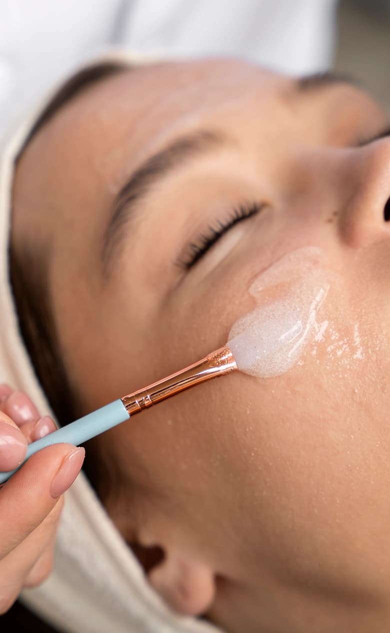Chemical Peel Treatment