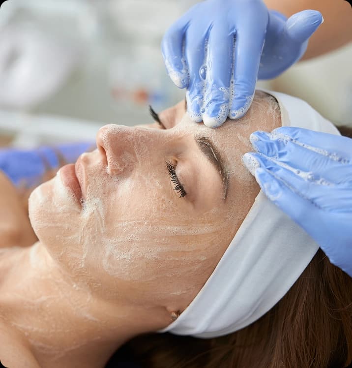 Chemical peel treatment benefits