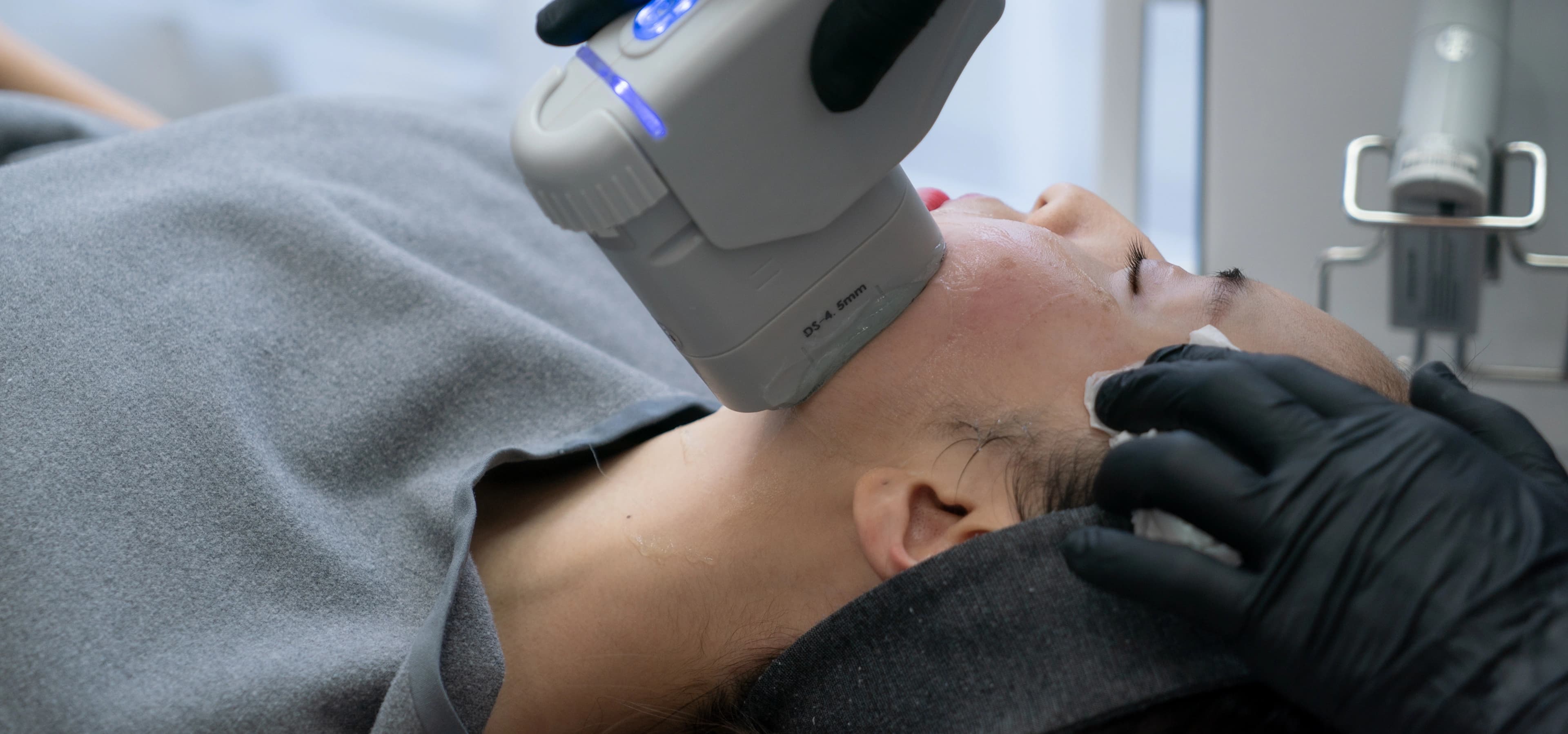 Laser Skin Resurfacing