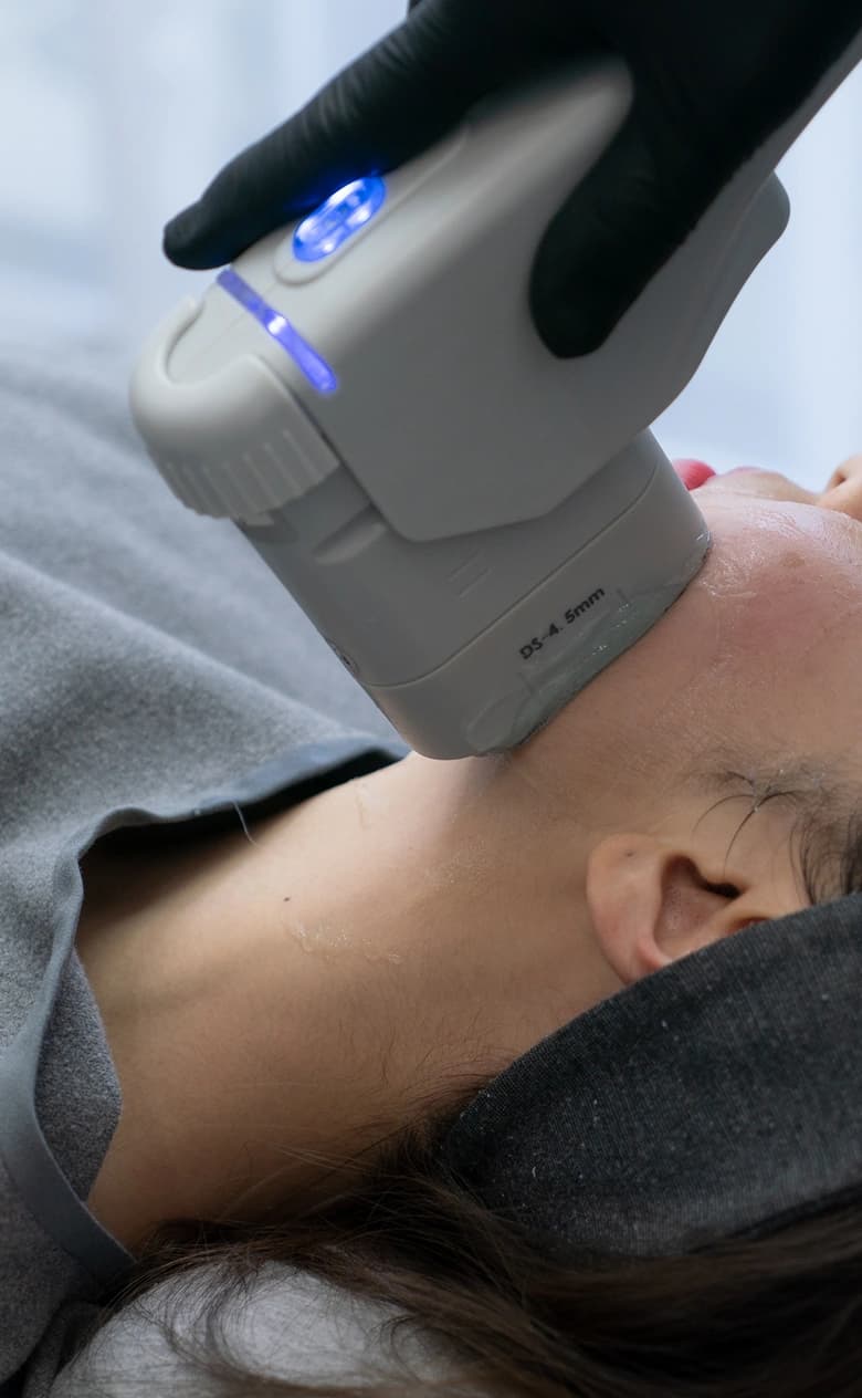 Laser Skin Resurfacing