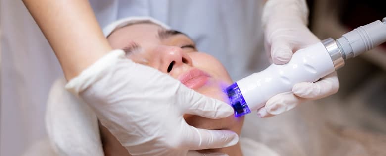 Laser Skin Resurfacing Treatment