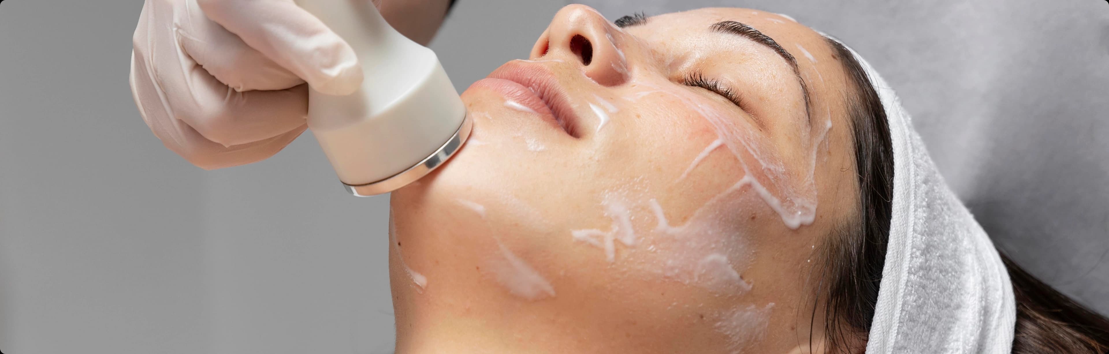 laser facial treatments