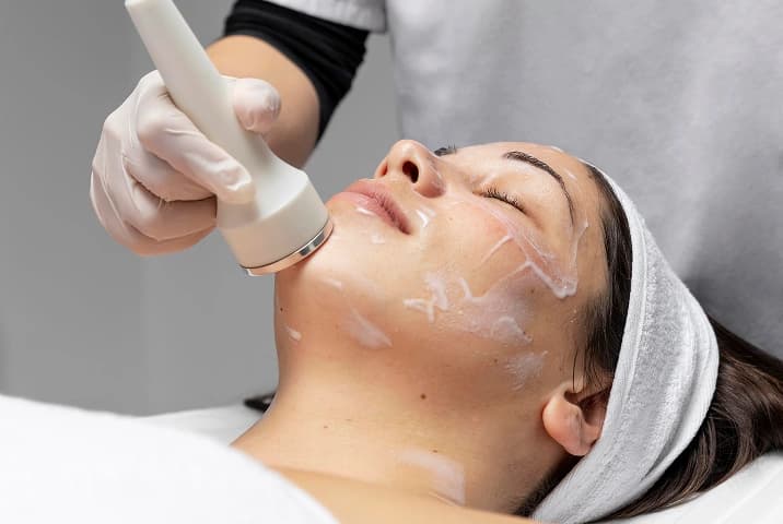 laser facial treatments