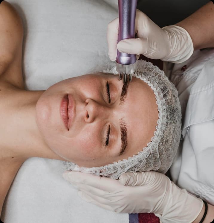 Microdermabrasion treatment benefits