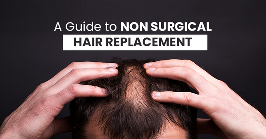 Non surgical hair replacement