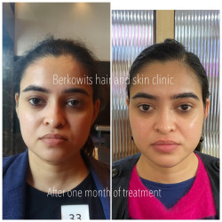 Glow & Sun Protect Combo For Glowing Skin - Berkowits