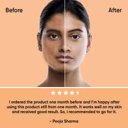 Buy Vitamin C Serum for Radiant Glow - Order Online at Berkowits