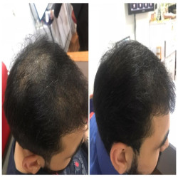 Berkowits Biotin Tablets for Hair Growth - 60 Tablets