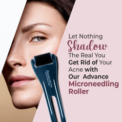 1 mm Micro-Needling Derma Roller | Berkowits