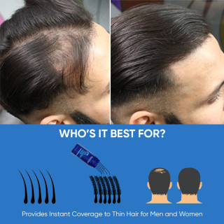 Hair Fiber Powder | Instant Coverage for Fuller Hair - Berkowits