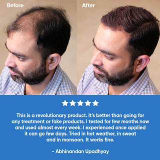 Hair Fiber Powder | Instant Coverage for Fuller Hair - Berkowits